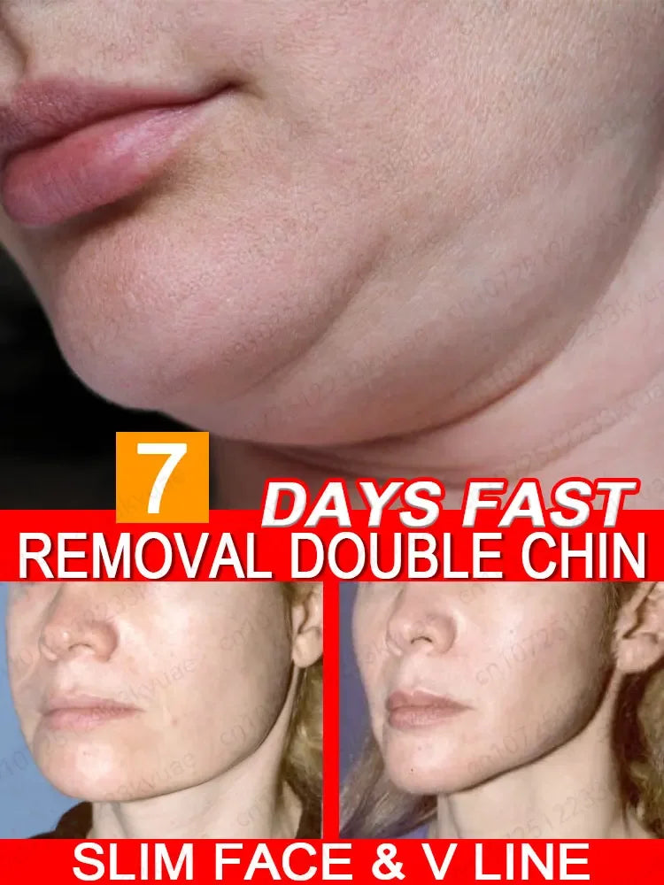 Face Slimming Cream, Eliminate Double Chin